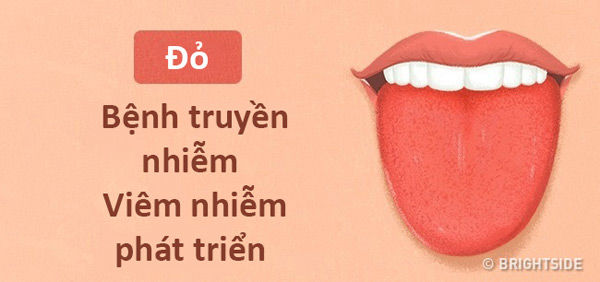 bestie chan doan benh qua mau luoi va moi