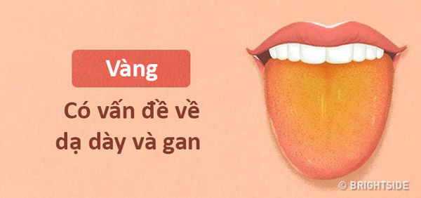 bestie chan doan benh qua mau luoi va moi