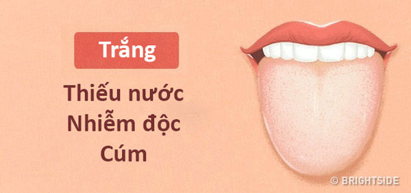 bestie chan doan benh qua mau luoi va moi