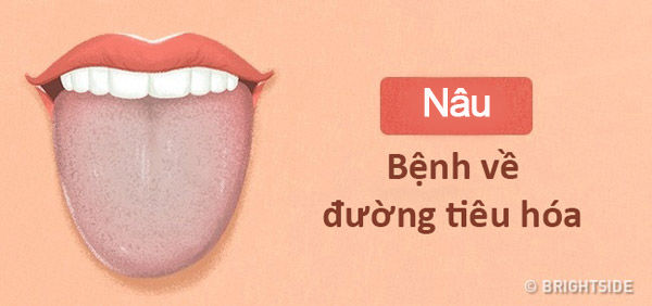 bestie chan doan benh qua mau luoi va moi