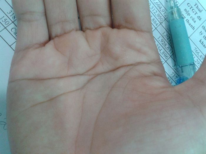 Bạn có may mắn thuộc 1,5% dân số có đường chỉ tay đặc biệt này không?