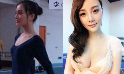 bestie truoc lum xum ngoai hinh ty tieu lo tung lo anh tham hoa dao keo