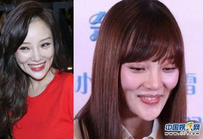 bestie truoc lum xum ngoai hinh ty tieu lo tung lo anh tham hoa dao keo