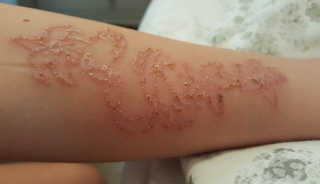 bestie tac hai xam henna