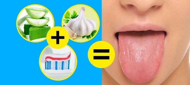 10 cách giúp bạn có hàm răng trắng, lưỡi sạch và hơi thở thơm mát