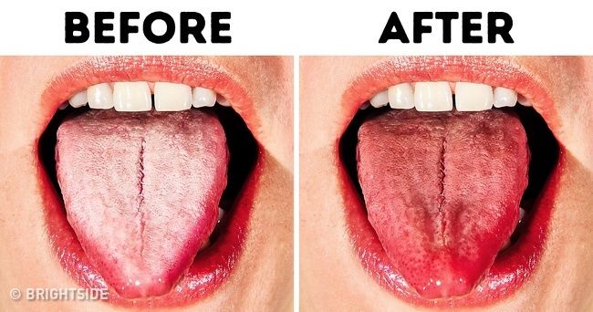 10 cách giúp bạn có hàm răng trắng, lưỡi sạch và hơi thở thơm mát