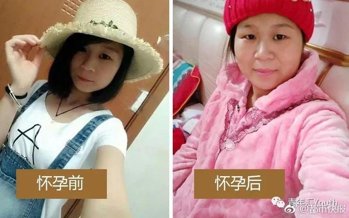 Bestie - Đau chi chi em xai hao, canh đan ong cung la nhung ke "bao mon" khong kem