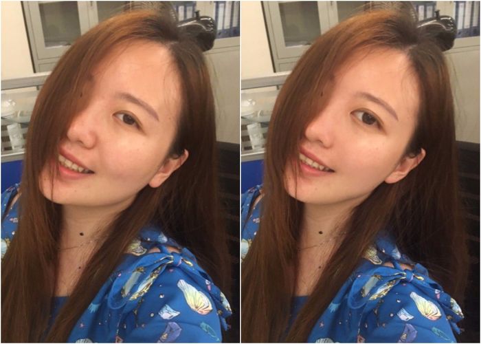 bestie anh truoc va sau khi chinh sua