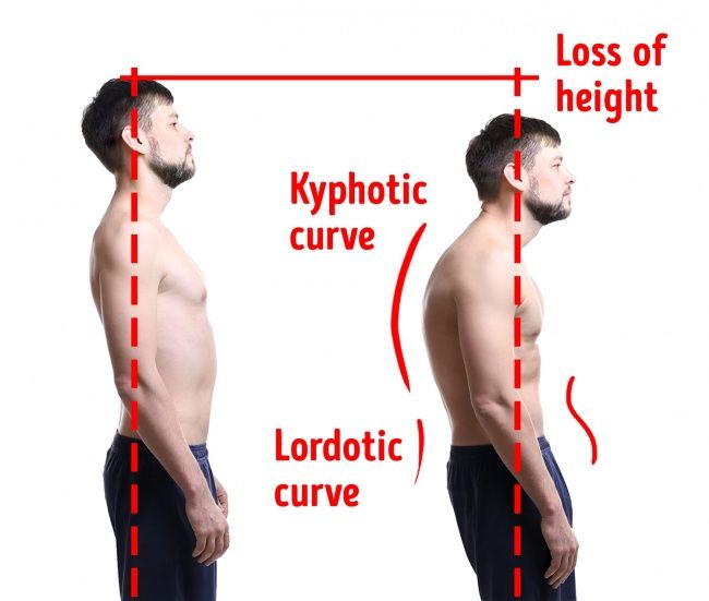 9 mẹo hữu ích giúp tăng chiều cao cho những nàng nấm lùn