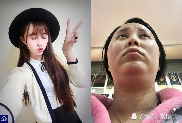 Bestie - Đau chi chi em xai hao, canh đan ong cung la nhung ke "bao mon" khong kem