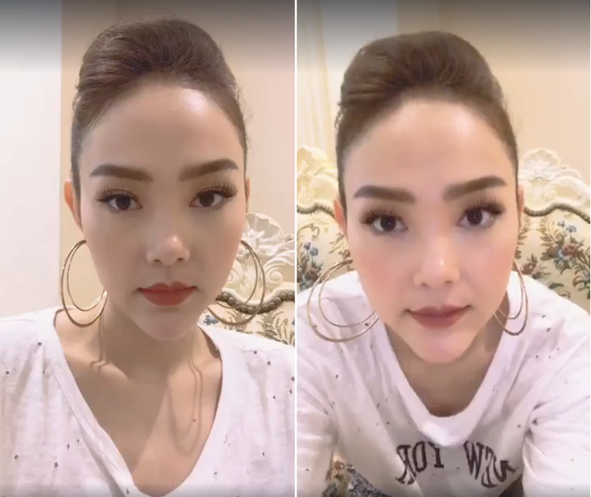 Nhìn lại dàn sao nữ Vbiz từng bị gán mác thảm họa thẩm mỹ