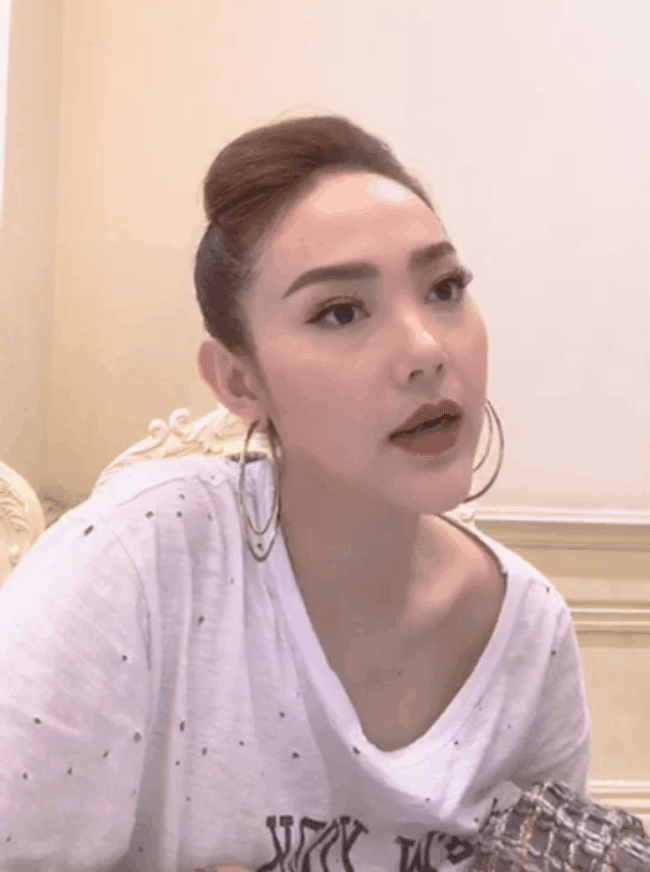 Nhìn lại dàn sao nữ Vbiz từng bị gán mác thảm họa thẩm mỹ