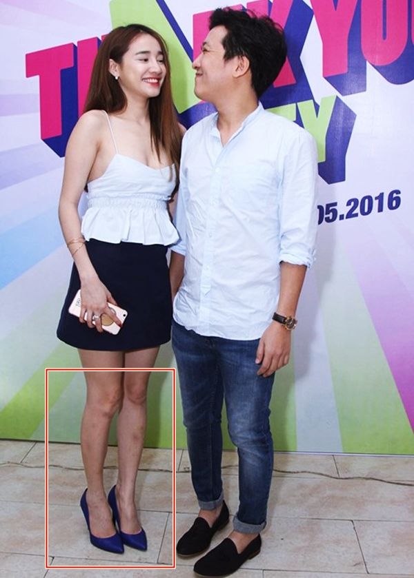 Bestie - Nhung my nhan tuong nhu hoan hao nhat showbiz lai vat va timdo che khuyet diem