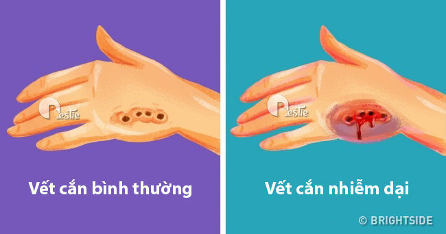 bestie kĩ năng sinh tồn trong cuộc sống