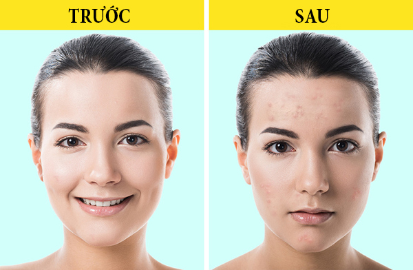 Những sản phẩm làm đẹp âm thầm tàn phá nhan sắc