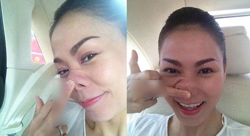 bi don tham my nguoi veo mui chung minh ke doi loi do app