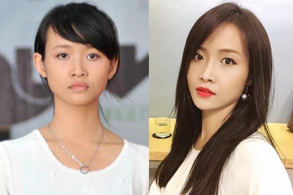 Nâng mũi, độn cằm sao nữ Việt còn chỉnh sửa bộ phận này mà ít ai để ý
