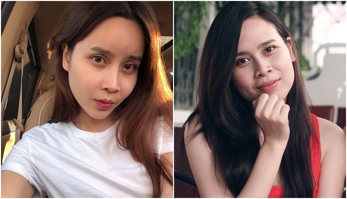 Nâng mũi, độn cằm sao nữ Việt còn chỉnh sửa bộ phận này mà ít ai để ý