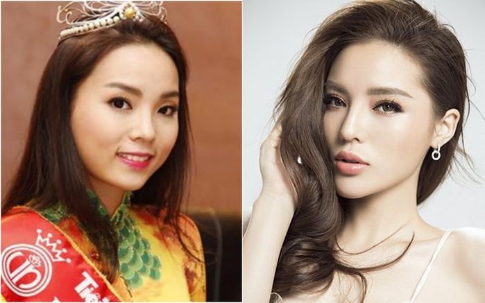 Những bộ phận biến dạng khủng khiếp của sao Việt ngày ấy giờ ra sao?