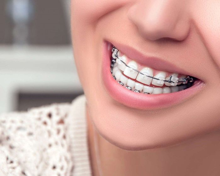 Những chuyện lạ khó tin nhưng hoàn toàn là sự thật