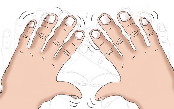 Những dấu hiệu cảnh báo bệnh nguy hiểm được biểu hiện qua đôi bàn tay