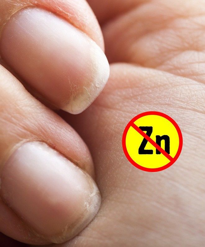 Những dấu hiệu cảnh báo bệnh nguy hiểm được biểu hiện qua đôi bàn tay