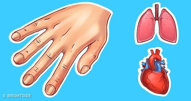 Những dấu hiệu cảnh báo bệnh nguy hiểm được biểu hiện qua đôi bàn tay