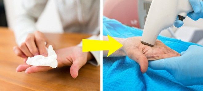 Những dấu hiệu cảnh báo bệnh nguy hiểm được biểu hiện qua đôi bàn tay