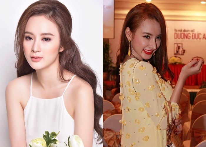 bestie sao chau a bien dang vi phau thuat tham my
