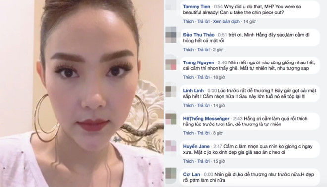 bestie sao chau a bien dang vi phau thuat tham my
