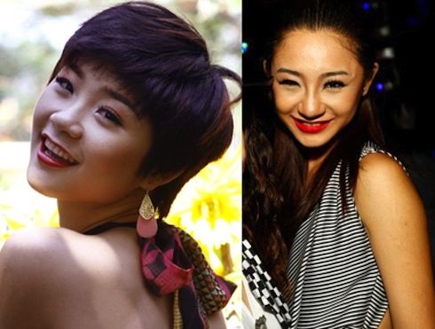 bestie sao chau a bien dang vi phau thuat tham my