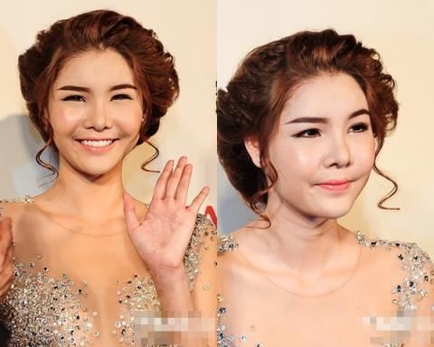 bestie sao chau a bien dang vi phau thuat tham my