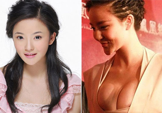 bestie sao chau a bien dang vi phau thuat tham my