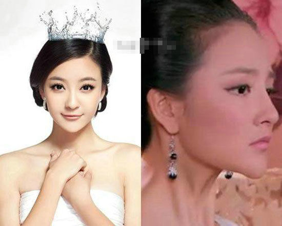 bestie sao chau a bien dang vi phau thuat tham my