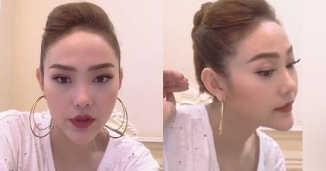 bestie sao chau a bien dang vi phau thuat tham my