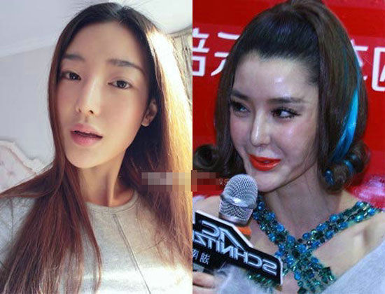 bestie sao chau a bien dang vi phau thuat tham my