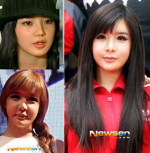 bestie sao chau a bien dang vi phau thuat tham my