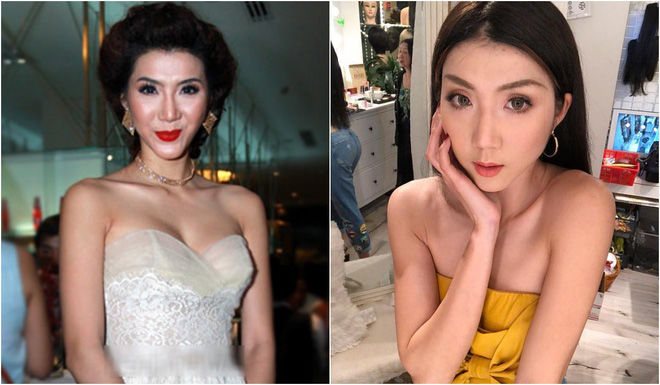 Những bộ phận biến dạng khủng khiếp của sao Việt ngày ấy giờ ra sao?