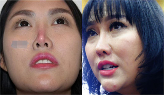 Những bộ phận biến dạng khủng khiếp của sao Việt ngày ấy giờ ra sao?