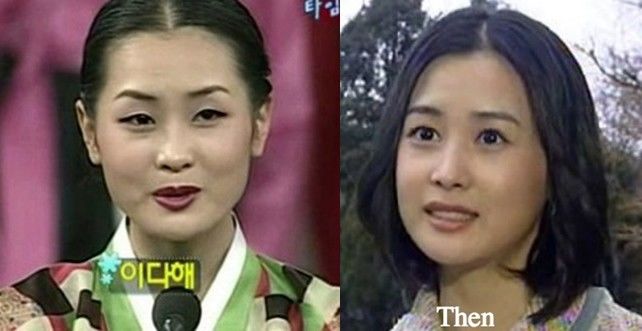 Những mỹ nhân xứ Hàn xinh đẹp nhờ phẫu thuật thẩm mỹ