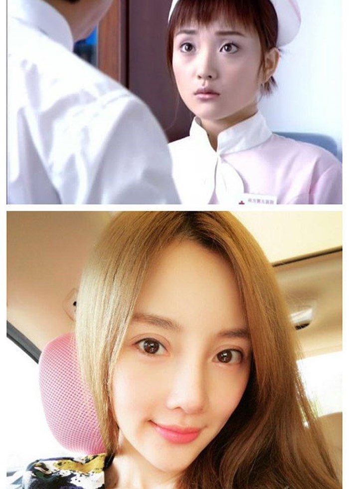 Những người đẹp showbiz lao đao vì hậu trùng tu nhan sắc hỏng