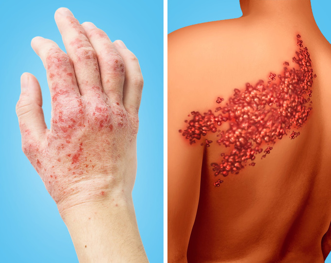 những dấu hiệu cảnh báo tim của bạn đang có vấn đề
