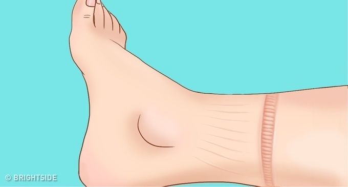 những dấu hiệu cảnh báo tim của bạn đang có vấn đề