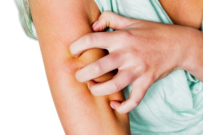 Bệnh lạ khiến nhiều người có ảm giác cả người luôn lúc nhúc côn trùng