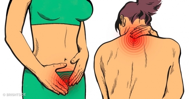 Dấu hiệu đau xơ cơ nguy hiểm sức khỏe nhưng nhiều người hay phớt lờ