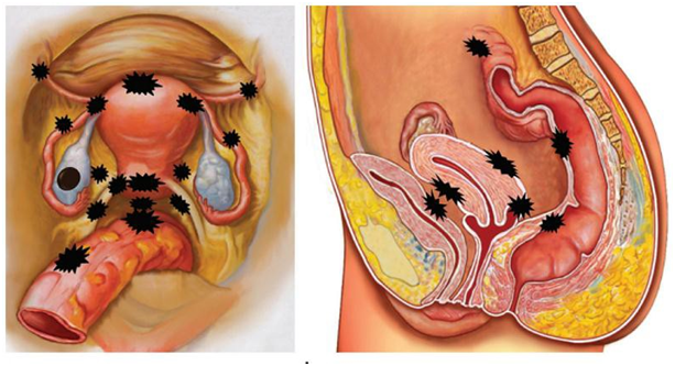 Chẩn đoán bệnh qua những biểu hiện đau bất thường ở vùng kín