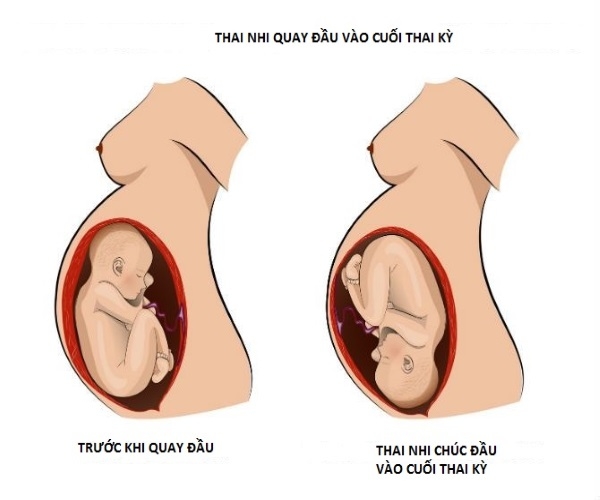 Dấu hiệu nhận biết thai nhi quay đầu và những kiến thức bổ ích