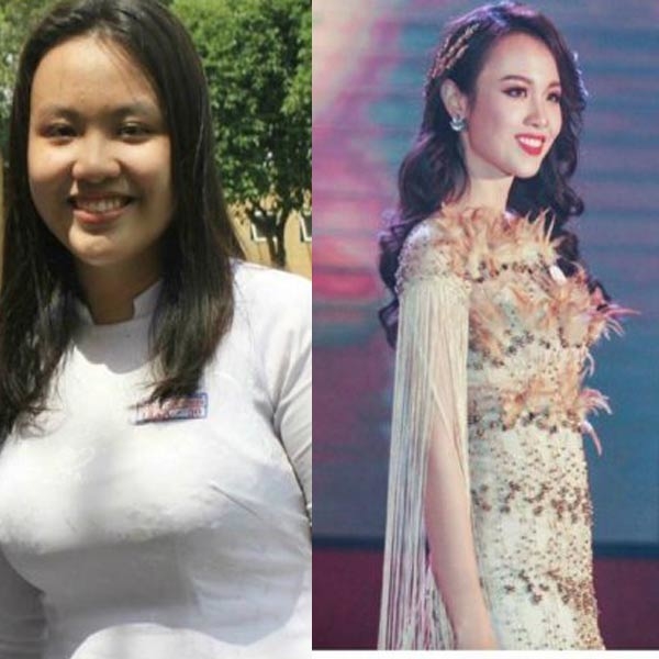 Sốc nặng trước những ca dậy thì thành công