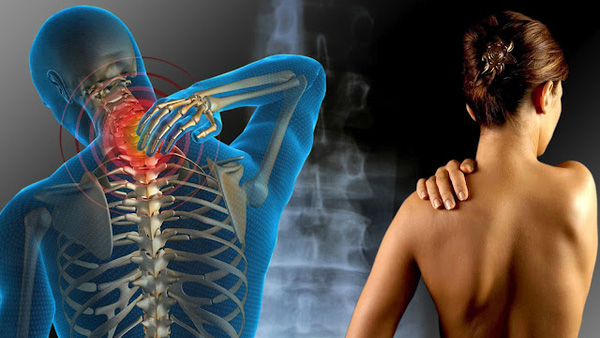 Dấu hiệu đau xơ cơ nguy hiểm sức khỏe nhưng nhiều người hay phớt lờ