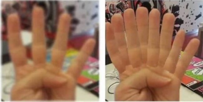 Nỗi khổ chỉ những người cận thị mới thấu hiểu